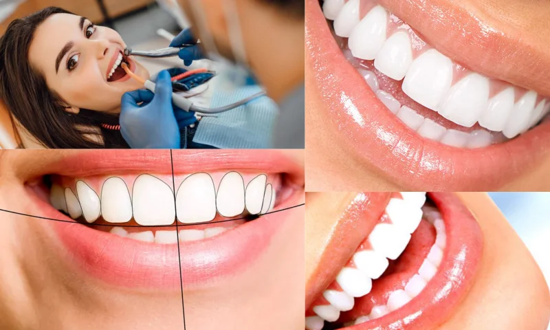 İstanbul'da Diş Kliniği - Dental Clinic in İstanbul Pahalı Mıdır?