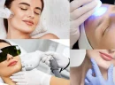 Yüz Epilasyonu Nedir ve Hangi Yöntemler Kullanılır?