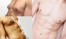 Jinekomasti Ne İşe Yarar?