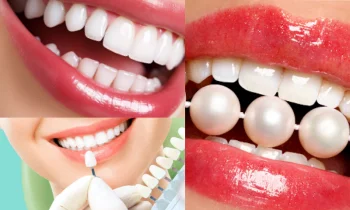 Zirkonyum Diş Kaplama Nedir ve Neden Tercih Edilir?