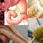 Impact of the Whipple Surgery Option on Pancreatic Cancer