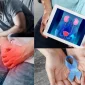 Prostat Tedavisi Ne İçin Yapılır?